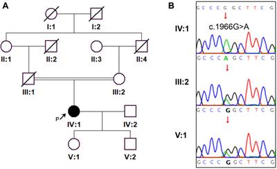 Case report: A homozygous ADAMTSL2 missense variant causes geleophysic dysplasia with high similarity to Weill-Marchesani syndrome